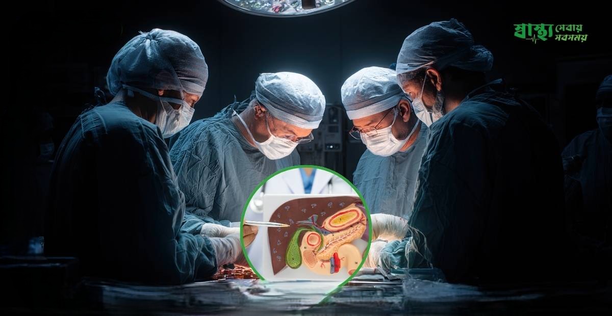 পিত্তথলির পারথর কি 1 6981442f651c4