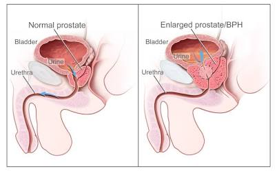 images 3