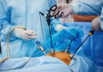 Laparoscopy-1536×1022-1