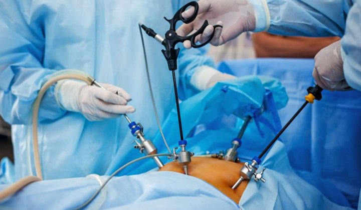 Laparoscopy 1536x1022 1